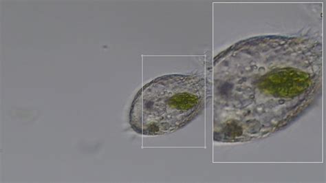  Coleps! A Tiny Ciliate With An Appetite For Bacteria And Algae