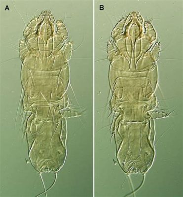  Quill Mite: A Microscopic Marvel Exuding Elegance Despite Its Unassuming Appearance!